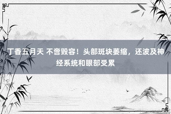 丁香五月天 不啻毁容！头部斑块萎缩，还波及神经系统和眼部受累
